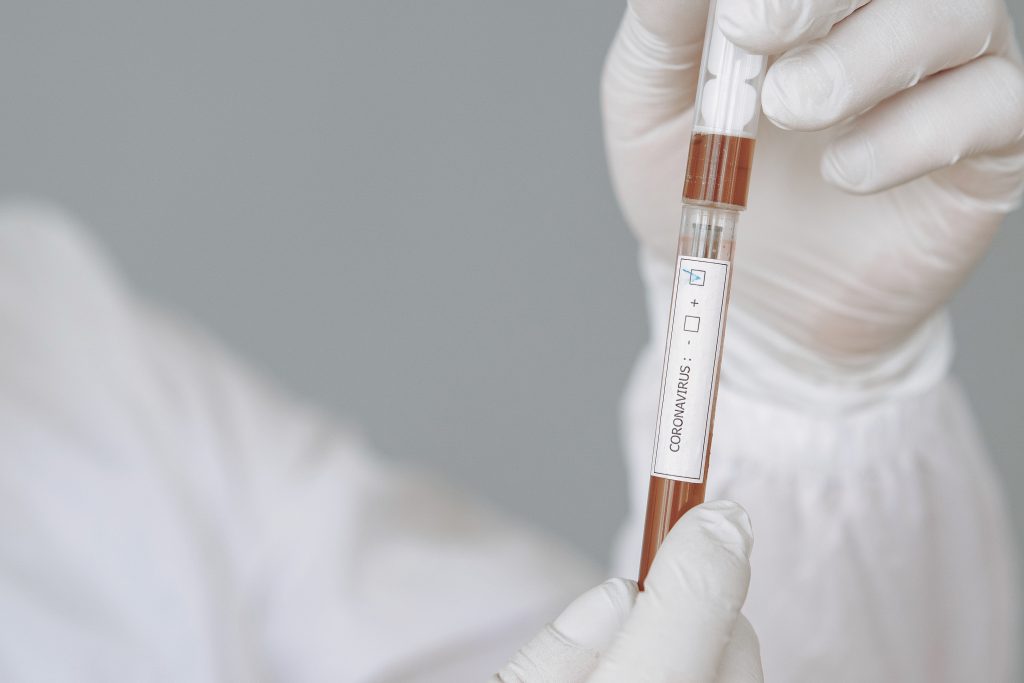 tested positive for Covid-19
